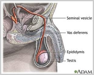 Epididymitis